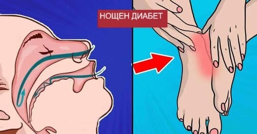 7 симптома на НОЩЕН ДИАБЕТ, които не трябва да игнорирате: Повечето хора не предполагат, че причината е това! - 8 500055645 1120923806737113 4313030814815753139 n