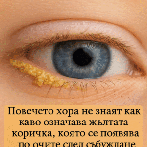 Повечето хора не знаят какво означава жълтата коричка, която се появява на очите им, когато се събудят 2 ugfhdml1lmbric4rkttf