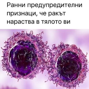 20 признака на рак, които хората често игнорират, докато не стане твърде късно 👇 50 520429722 763045176068717 6377988348328728227 n